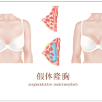 长沙假体隆胸哪家医院好？如何才能快速丰胸