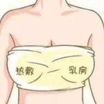 广州脂肪隆胸要多少钱？价格信息盘点，2026价格详情查看