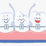 上海牙齿矫正多少钱？影响价格的因素、不同方式的差价这里看