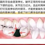 齐齐哈尔种植牙多少钱一颗？2026价格表新鲜出炉！