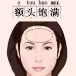 成都脂肪填充额头要多少钱？医生+价格对比