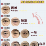十堰去眼袋手术多少钱？本地医美老炮儿扒全价格内幕+避坑指南