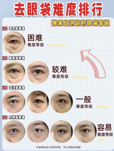 十堰去眼袋手术多少钱？本地医美老炮儿扒全价格内幕+避坑指南