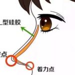 北京刘彦军做鼻子风格是怎么样的?案例点评