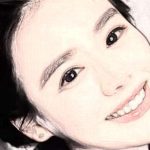 上海玻尿酸去眉间纹医生