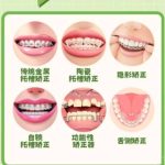 福州地包天矫正需要多少钱？推荐几家口碑好实力强的医院！