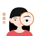 深圳北大医院提眉的费用多少？6000元起，崔永言、何君君等医生不错