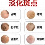 八大处霍孟华光子嫩肤案例图展示！做嫩肤技术口碑好！2026价格速查