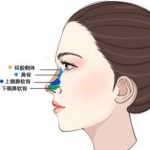 石家庄注射隆鼻价格多少钱？当地性价比机构名单汇总！速速收藏