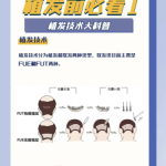 台州医院植发价格大揭秘！2026最新价格表+3个真实案例，省钱避坑看这篇就够了