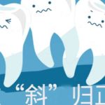 上海第九人民医院正畸多少钱？1万元起，口碑医生、案例分享！