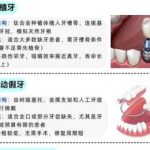 在桂林种植一颗牙齿要多少钱？价格在3k到1w不等含人气医院推荐！