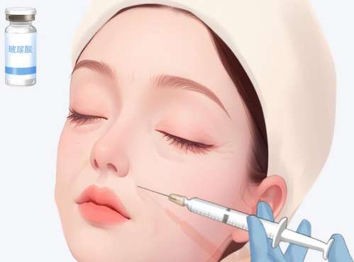广州曙光张小芸微调贵吗？乔雅登6千元起\少女针1.2万元起\濡白1.3万元起