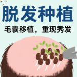 上海植发大概多少钱 · 预算范围，不同技术价格对比