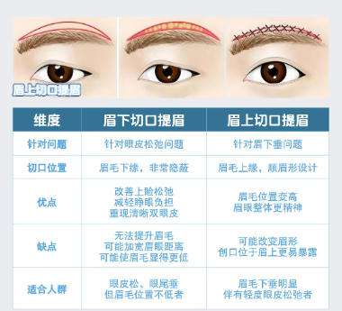 无锡提眉切眉价格贵不贵？推荐几家口碑好又实惠的医院！