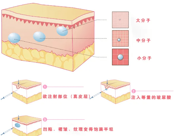 长沙馒化脸修复哪位医生好？看这几点不踩坑