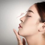 自体软骨隆鼻方式有哪些？自体软骨隆鼻在哪取软骨好