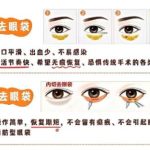 成都华西医院做眼袋手术多少钱？人气医生团队相关简介！