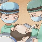 哈医大二院植发一个毛囊多少钱？2026年价格10-30元，更多重点一次讲透