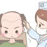 漳州医院植发多少钱？1万元起，漳州市医院技术稳准强，带避坑攻略