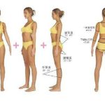 宁波中医院吸脂多少钱？2026年价格2万元不等，抽脂减肥必看功课！