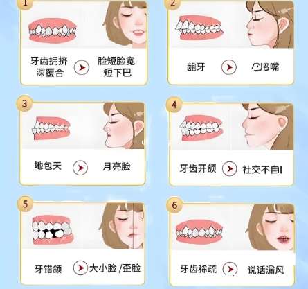 合肥地包天下颌骨矫正费用贵不贵？推荐几家口碑好又实惠的机构！