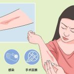 西京医院点阵激光去疤痕价格多少?2000元起，靠谱医生以及项目科普