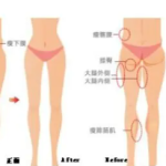 南京张路做手术咋样？微创个性化设计，审美紧跟潮流