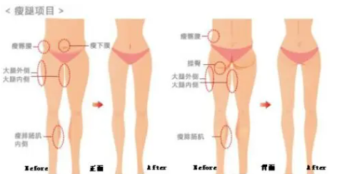 南京张路做手术咋样？微创个性化设计，审美紧跟潮流