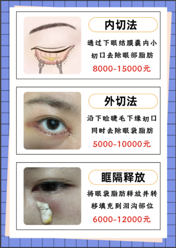 马鞍山割眼袋多少价格？从3000到15000，差价背后藏着”看不见的价值”
