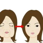 西京医院除皱多少钱？大概3000元起，医生推荐|案例分享，附价格表