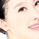 洛阳宝尼达填充额头比较好的医生一些