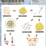 北京全脸填充脂肪多少钱？参考价15556-40938元左右！