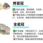 沈阳美容冠修复哪里好？多少钱？价格表更新！