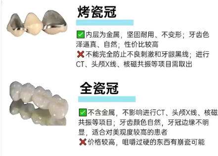 沈阳美容冠修复哪里好？多少钱？价格表更新！
