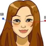 北京八大处美容医院做眼袋多少钱？3500元起，医生|案例分享