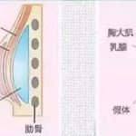 栾杰医生隆胸技术好不好？收费贵吗？