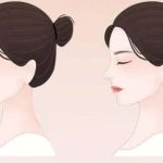 广州隆鼻哪个医生能做|前三名医生分析