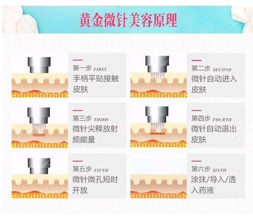 珠海黄金微针第五代多少钱？分析韩妃\如花等5家机构，3800-6800元起