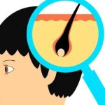 中日友好医院植发价格多少？这份价格清单与医生参考请收好