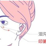 上海填充泪沟哪家医院好需要多少钱？5000元起；上海九院、薇琳等热门机构上榜