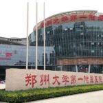 王琪影双眼皮案例，轻松打造明眸大眼