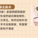 北京301医院祛眼袋需要多少钱？戳进来看具体相关介绍！