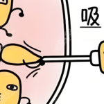 北京协和吸脂手术多少钱啊？手术费、住院费一文拆给你看