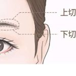 张家口提眉多少钱？3000元起，靠谱医院推荐以及项目科普