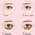 张栋益在河南口碑好吗？去眼袋技术好不好？客户口碑附上