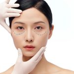 眼部吸脂手术会反弹么？眼袋美容手术方法