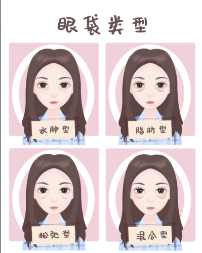 上饶哪家医院去眼袋好？3家优质医院实测+术式选择指南