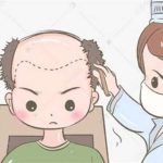 杭州植发价格是多少？看影响价格因素有哪些？