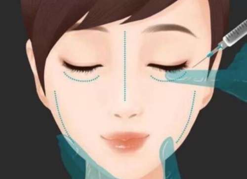 成都玻尿酸填充多少钱一支